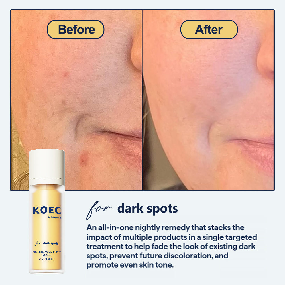 KOEC Brightening Dark Spot Serum