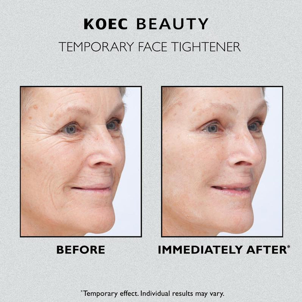 KOEC Temporary Face Tightener