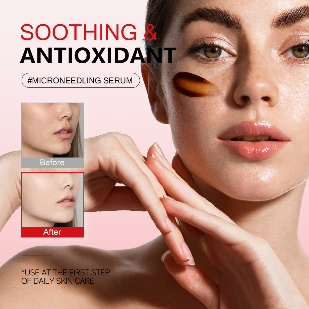 Dragon Blood Microneedling Serum