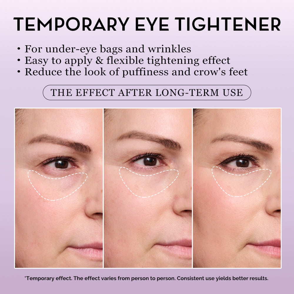Temporary Eye Tightener