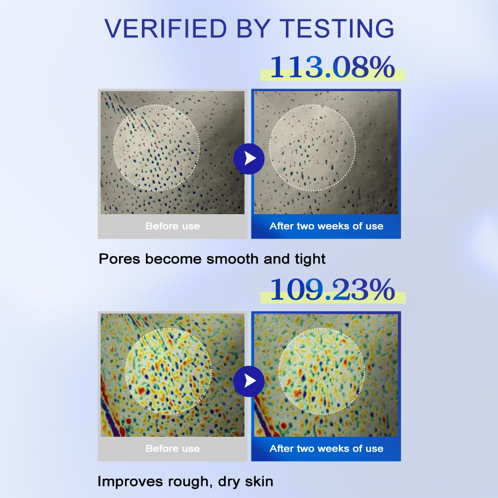 KOEC One Day Exosome Shot Pore Ampoule 2000